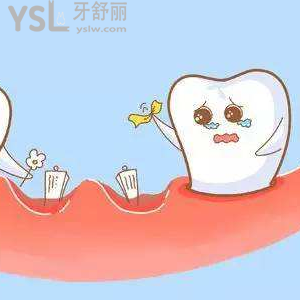 牙齒為什么會一顆一顆脫落？
