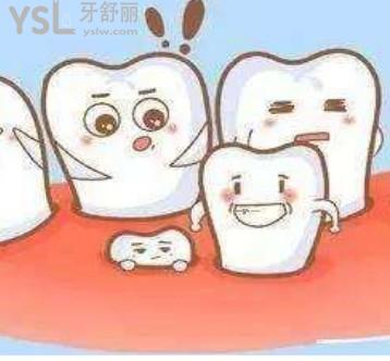 成人為什么還會有多生牙 還要拔嗎？