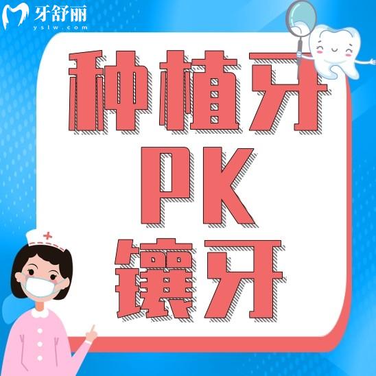 種植牙和鑲牙哪個(gè)比較好一點(diǎn)？應(yīng)該選擇哪個(gè)？