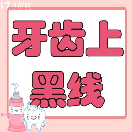 牙齒上的黑線一定是蛀牙嗎？一定要補牙治療嗎