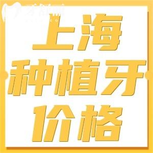 上海種植牙價格一般一顆多少錢?2024全新價格表含半口/全口種牙費用