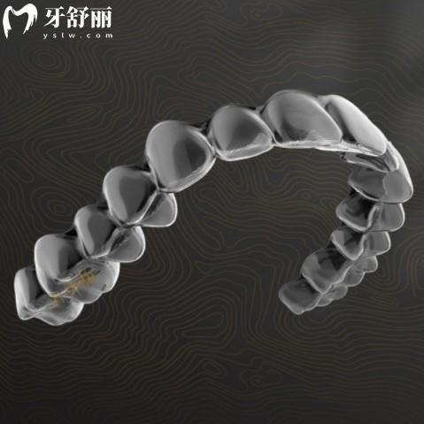 國產(chǎn)品牌美立刻隱形矯正怎么樣？優(yōu)缺點價格解讀來看值不值得選