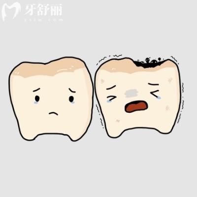 齲齒會引發(fā)其他疾病嗎?來看看怎么治療比較好