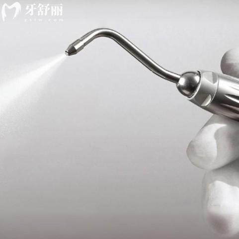 洗牙加噴砂是什么意思？洗牙中噴砂拋光具體操作介紹