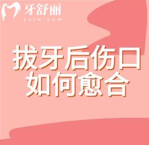 拔牙后如何幫助傷口愈合？拔牙后飲食指南/注意事項奉上詳解