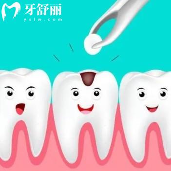 自己網(wǎng)上買的補牙劑補牙顆粒能用嗎？牙醫(yī)告知小心得不償失