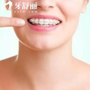 戴牙套里面的牙齒容易壞嗎？不容易，口腔及時清理及良好衛(wèi)生習慣可避免