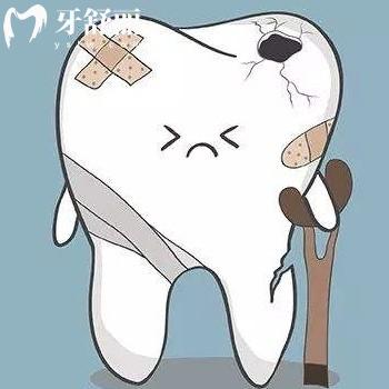 烤瓷牙里面的真牙痛怎么辦?根據(jù)以下原因來解決哦