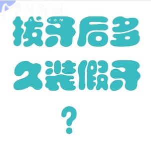 拔牙后多久裝假牙？一分鐘讓你掌握口腔小知識