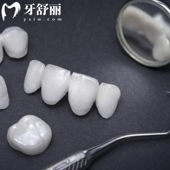 想要牙貼面當(dāng)天就能做好？！除了選醫(yī)生還要看cad修復(fù)