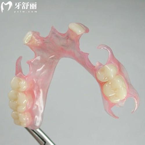 固定假牙好還是活動(dòng)假牙好?從各自的優(yōu)缺點(diǎn)和價(jià)格了解下就懂了