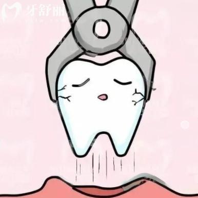 拔牙多少錢一顆牙2024，拔殘根/乳牙/智齒可用醫(yī)保