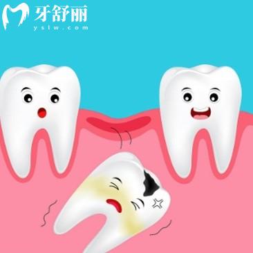 40歲缺牙導致后面牙齒傾斜怎么辦?以下3種方法都可以改善