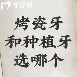 烤瓷牙和種植牙選哪個？各有自己的優(yōu)勢根據(jù)自身選擇即可