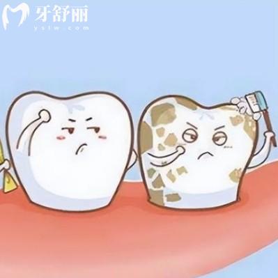 牙齒上有牙菌斑怎么去除?需要長期的堅持和正確的方法哦