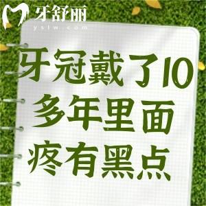 牙冠戴了10多年里面疼有黑點(diǎn)?小心各種炎癥找上門趕緊治療