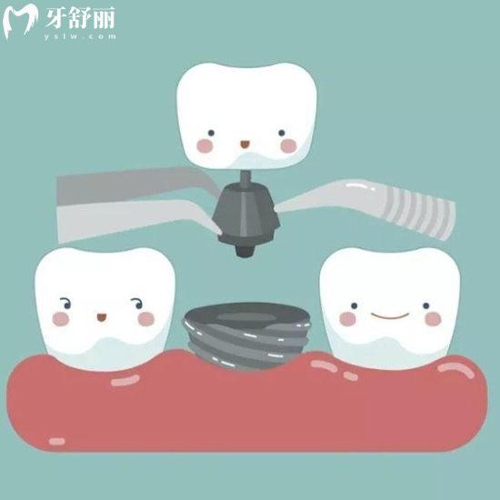 為什么網(wǎng)上這么多種植牙失敗案例，還敢種牙嗎？