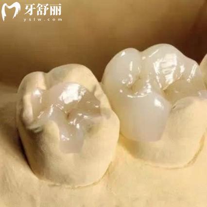 補完牙齒覺得牙齒咬合時有些高怎么辦?需要對牙齒位置進行再次調(diào)整