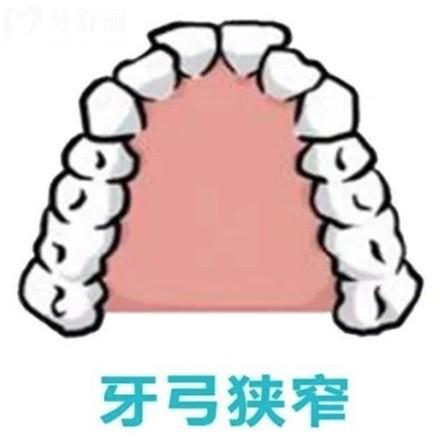 解答兒童牙弓狹窄需要干預(yù)嗎？會(huì)自己?jiǎn)? class=