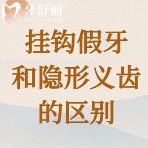 掛鉤假牙和隱形義齒的區(qū)別在哪里？如何正確的選擇呢？
