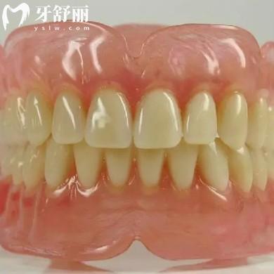 吸附式義齒適合什么人群?從優(yōu)缺點(diǎn)價(jià)格來看看怎么回事