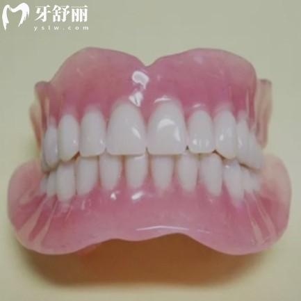解答bps吸附性義齒是什么材料?從優(yōu)缺點/價格參考很不錯哦