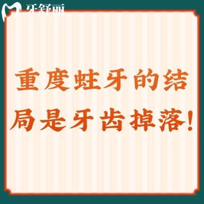重度蛀牙的結(jié)局是牙齒掉落！蛀牙不可小覷，要及早防治