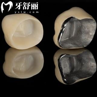牙冠用了10年后可以再換嗎？拆冠重做的牙齒還能用嗎？