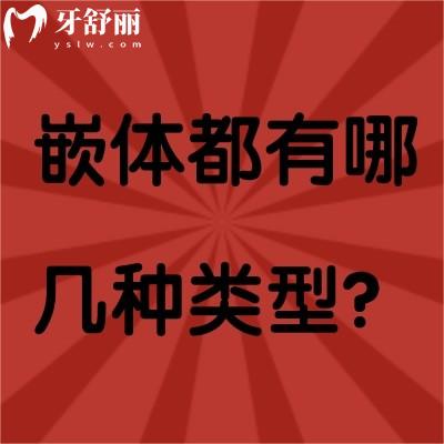 嵌體都有哪幾種類型？什么情況下適合做嵌體？