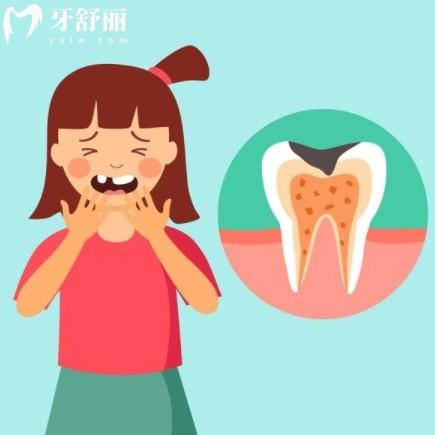 門牙能不能做根管治療，做完有必要帶貼面或者牙冠嗎?