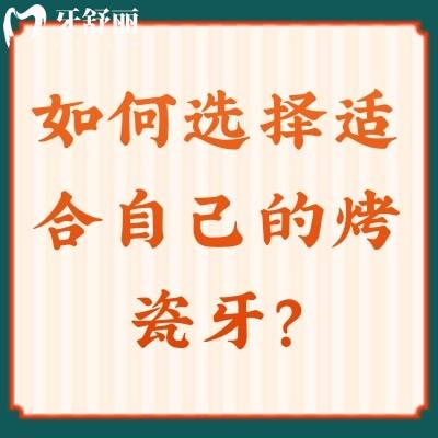 如何選擇適合自己的烤瓷牙？從顏色+質(zhì)量+材質(zhì)+工藝來(lái)選擇