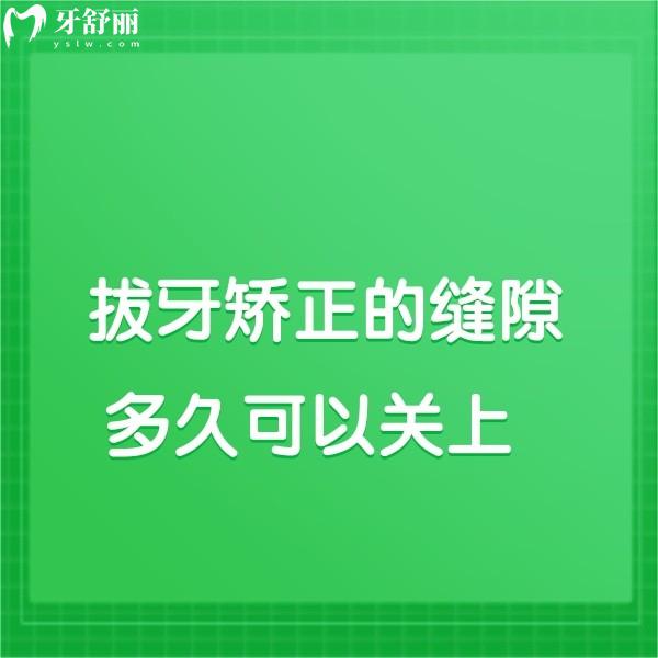 拔牙矯正的縫隙多久可以關(guān)上?年齡/矯正方式/錯(cuò)位程度不同關(guān)閉時(shí)間不同