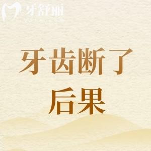 牙齒斷了不去處理的后果？牙醫(yī)建議不要小事拖大事以免后果嚴(yán)重