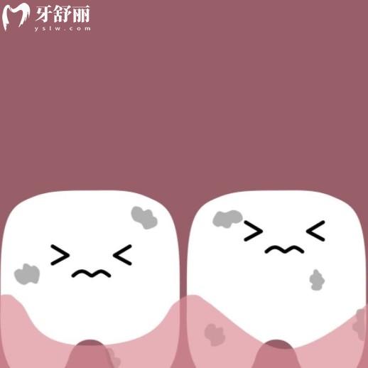 牙齦變黑了還能嗎？盤(pán)點(diǎn)變色的原因和應(yīng)對(duì)措施