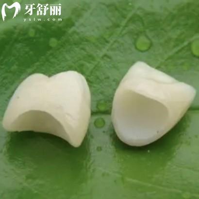 裝假牙裝什么材質(zhì)的好一點(diǎn)?樹脂/全瓷/金屬/塑料假牙對(duì)比了解下