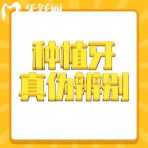 種植牙真?zhèn)伪鎰e方法：這五種方式讓您獲得安全的/真的種植體