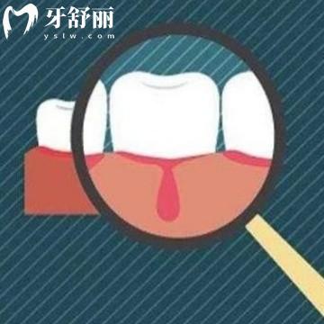 如果缺鈣的話牙齒會松動嗎?其實是對骨骼的影響從而導(dǎo)致松動