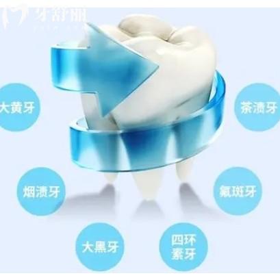 家庭美白和診室美白的區(qū)別，在價格/成效/維持時間上對比