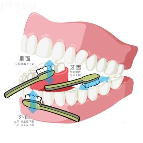 看完發(fā)現(xiàn)這多年的牙白刷了，快來(lái)學(xué)習(xí)刷牙正確方法步驟