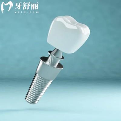 種植牙一般會痛幾天能好??？根據(jù)自身情況基本一周后就進入愈合期