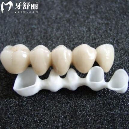 國產(chǎn)二氧化鋯全瓷牙和進口的有什么區(qū)別?從壽命/價格/優(yōu)缺點一探究竟