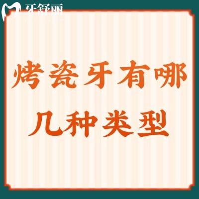 烤瓷牙有哪幾種類型？全瓷冠/瓷貼面/烤瓷橋優(yōu)勢(shì)大介紹