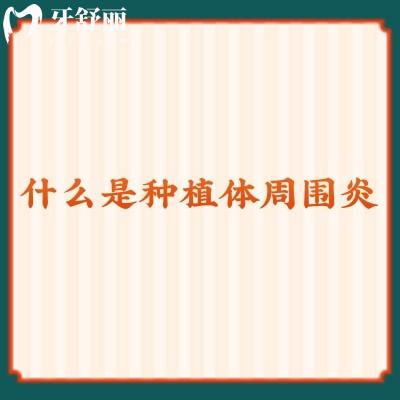 什么是種植體周圍炎？解密原因+治療方法+預(yù)防