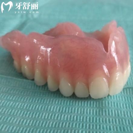 醫(yī)生不建議做吸附式假牙的原因:那就要從吸附式假牙的優(yōu)點和缺點/使用人群了解了