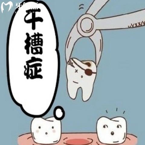 拔牙多久能排除干槽癥？來看看怎么判斷有沒有干槽癥