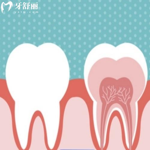 沒有牙神經(jīng)的牙齒還能用多久？來看看如何治療比較好