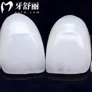 南京牙貼面哪家醫(yī)院做得好？24版價格收費和牙科排行公布