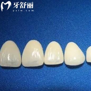 全瓷牙冠和二氧化鋯牙冠有區(qū)別嗎？幾百和上千的牙冠主要有以下差別
