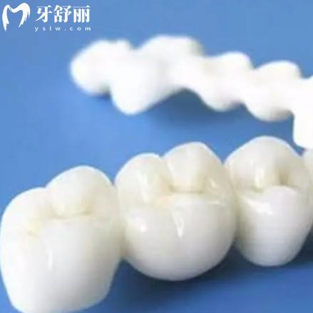 為什么不建議做牙冠？看完鑲牙的優(yōu)缺點再做考慮