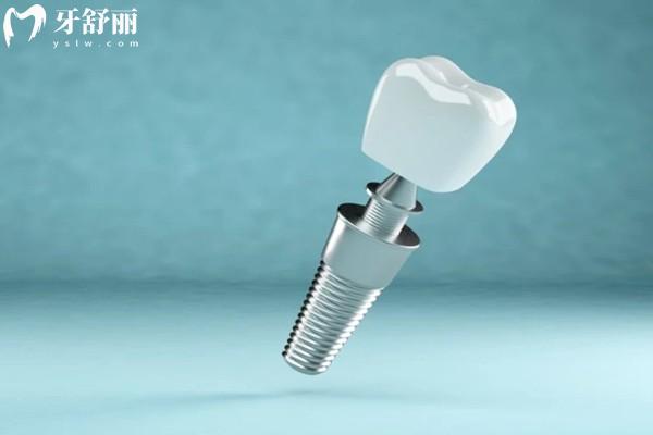 全口義齒疼痛的原因分析，假牙不穩(wěn)定等因素附解決方式+義齒價(jià)格表